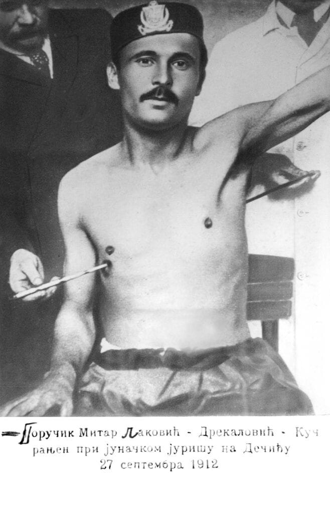 Слика која је задивила свијет: Митар Лаковић на лијечењу у Прагу